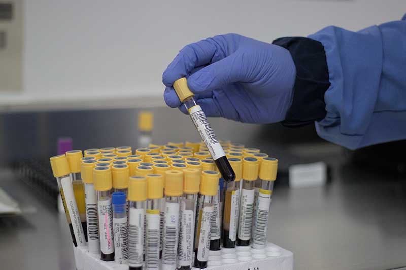 Laboratorio de Referencia